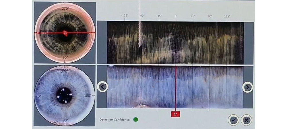Новый уровень точности