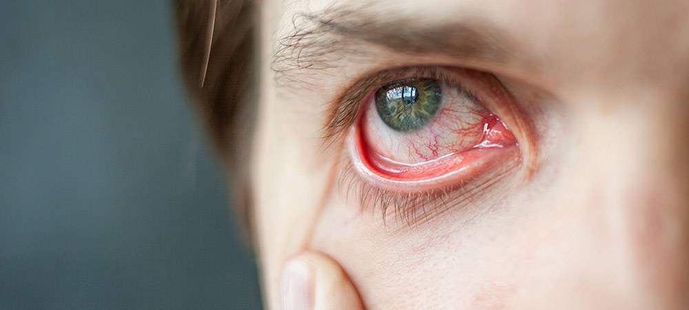 Правильный уход за сухой кожей вокруг глаз - Космецевтика MyIDi