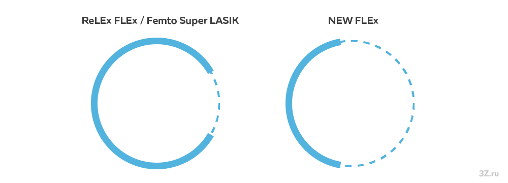 Сравнение разрезов роговичного лоскута при различных методах лазерной коррекции зрения